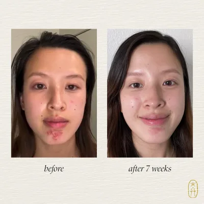 Clarify Botanical Serum