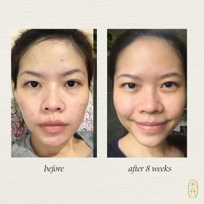 Clarify Botanical Serum