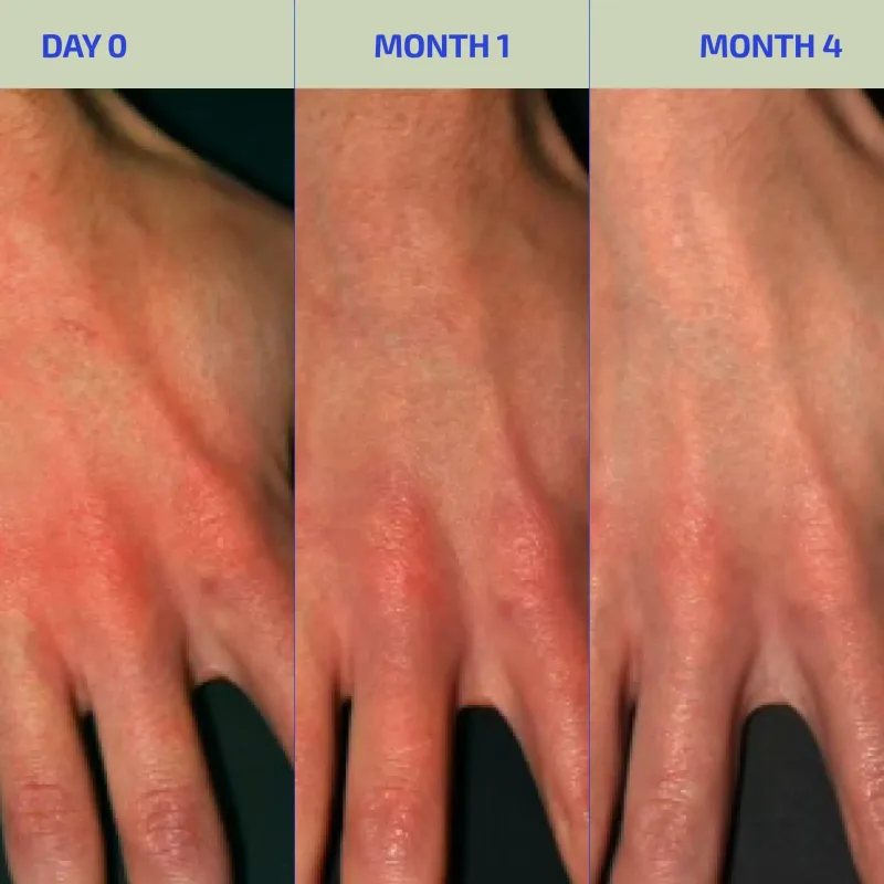 Codex Labs: BIA Eczema Relief Lotion